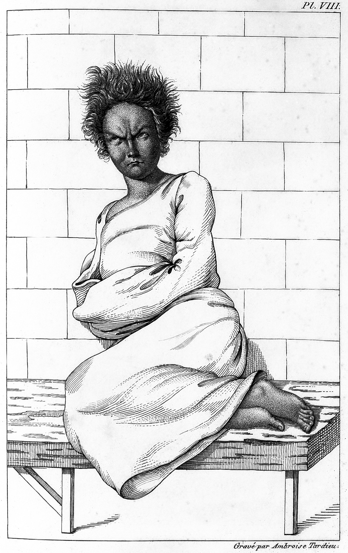 Ambroise Tardieu - Maniac, during the fit