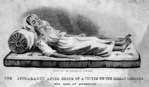 Cholera