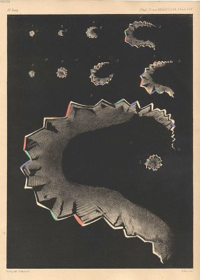 Scintillating Scotoma - Hubert Airy