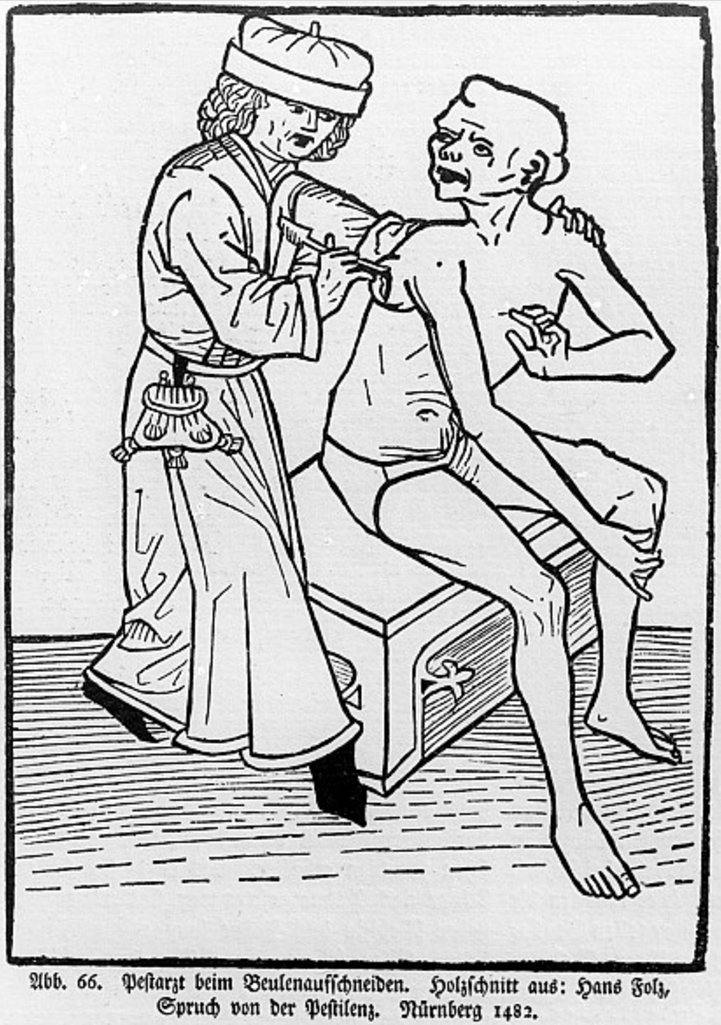 Hans Folz's A Plague Doctor lancing a bubo