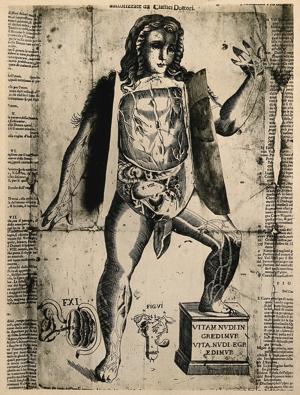A Female Flap Anatomy Fugitive Sheet, Thorax and Abdomen